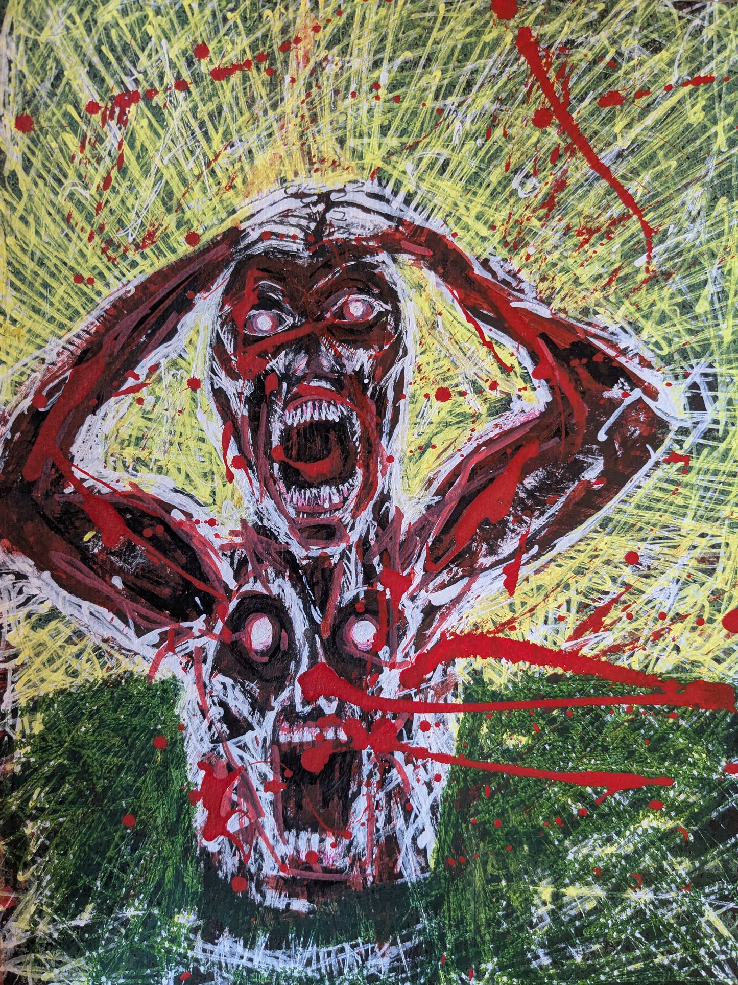 PAIN